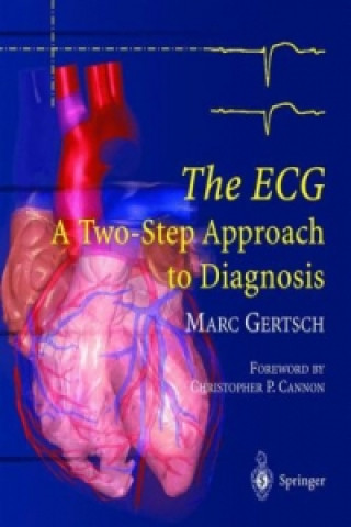 Buch ECG Marc Gertsch