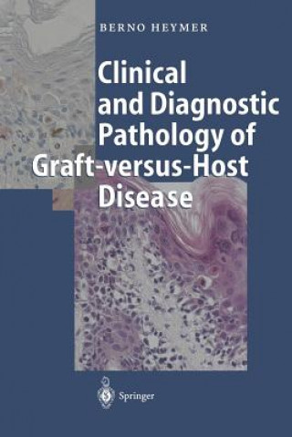 Carte Clinical and Diagnostic Pathology of Graft-versus-Host Disease Berno Heymer