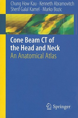 Könyv Cone Beam CT of the Head and Neck Chung H. Kau