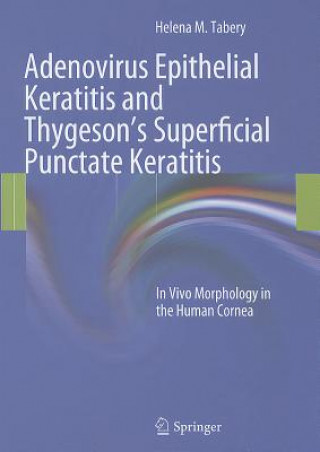 Książka Adenovirus Epithelial Keratitis and Thygeson's Superficial Punctate Keratitis Helena M. Tabery