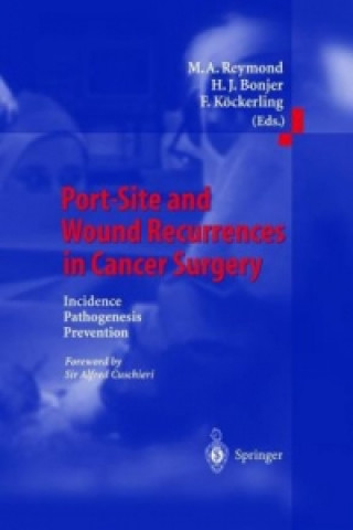 Βιβλίο Port-Site and Wound Recurrences in Cancer Surgery H. J. Bonjer