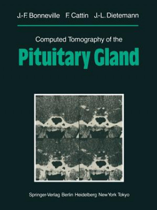 Könyv Computed Tomography of the Pituitary Gland Jean-Francois Bonneville