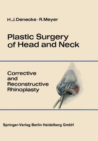 Buch Plastic Surgery of Head and Neck Hans J. Denecke