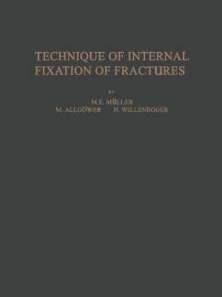 Carte Technique of Internal Fixation of Fractures M. E. Müller