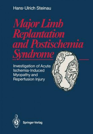 Книга Major Limb Replantation and Postischemia Syndrome Hans-Ulrich Steinau