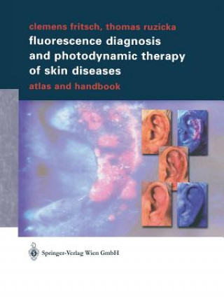 Carte Fluorescence Diagnosis and Photodynamic Therapy of Skin Diseases Clemens Fritsch