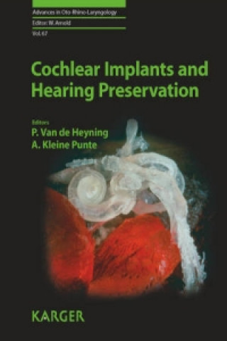 Carte Cochlear Implants and Hearing Preservation P. Van de Heyning