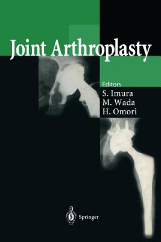 Książka Joint Arthroplasty Shinichi Imura