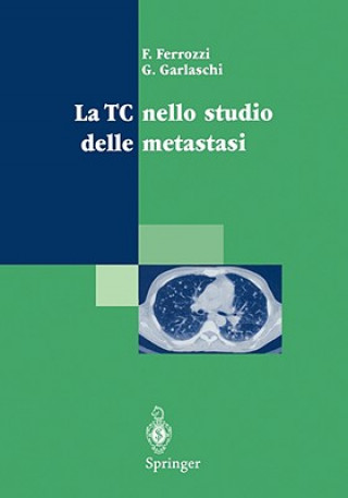 Kniha La Tc Nello Studio Delle Metastasi F. Ferrozzi