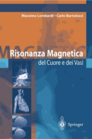 Książka Risonanza Magnetica del Cuore e dei Vasi Massimo Lombardi