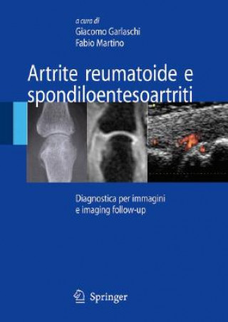 Könyv Artrite reumatoide e spondiloentesoartriti Giacomo Garlaschi