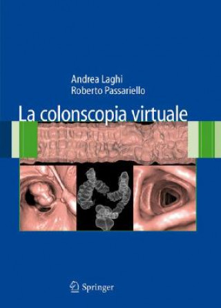 Kniha La colonscopia virtuale Andrea Laghi