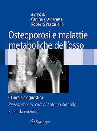 Kniha Osteoporosi e malattie metaboliche dell'osso Carlina Albanese