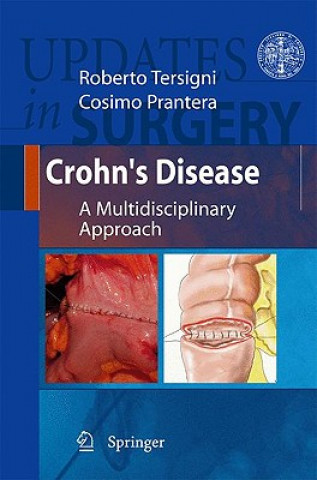 Kniha Crohn's Disease Cosimo Prantera