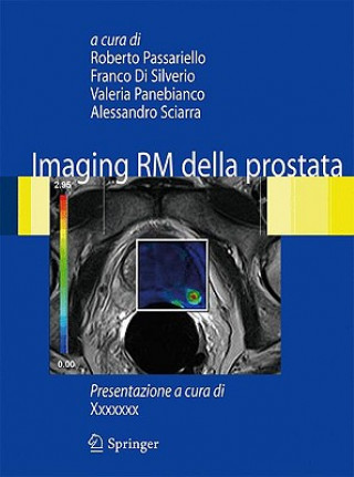Книга Imaging RM della prostata Roberto Passariello