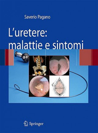 Kniha L'uretere: malattie e sintomi Saverio Pagano