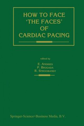 Carte How to face 'the faces' of CARDIAC PACING Erik Andries