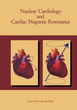 Kniha Nuclear Cardiology and Cardiac Magnetic Resonance Ernst E. Wall