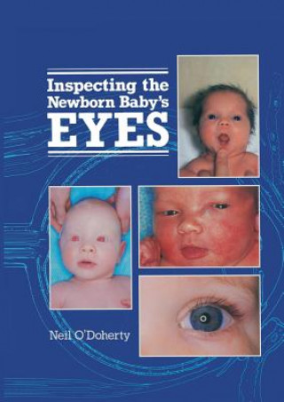Carte Inspecting the Newborn Baby's Eyes N. O'Doherty