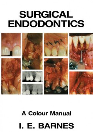 Kniha Surgical Endodontics I. Barnes