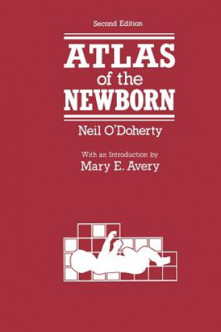 Kniha Atlas of the Newborn N. O'Doherty