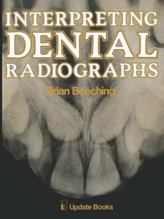 Carte Interpreting Dental Radiographs B. W. Beeching