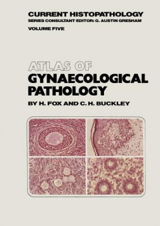 Kniha Atlas of Gynaecological Pathology H. Fox