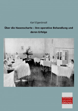 Kniha Über die Hasenscharte Karl Eigenbrodt