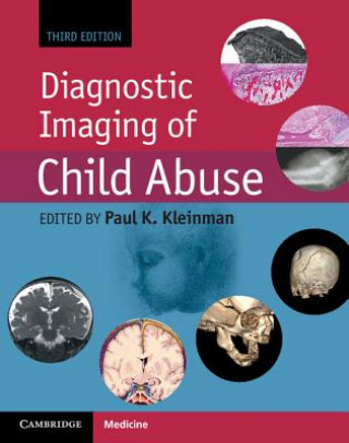 Książka Diagnostic Imaging of Child Abuse Paul K. Kleinman