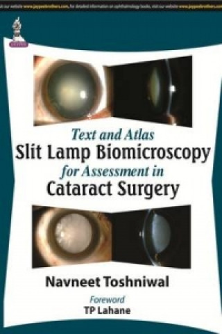 Carte Text and Atlas: Slit Lamp Biomicroscopy for Assessment in Cataract Surgery Navneet Toshniwal