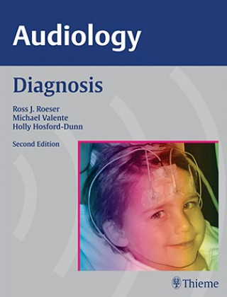 Könyv AUDIOLOGY Diagnosis Ross J Roeser