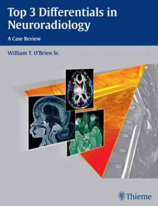 Książka Top 3 Differentials in Neuroradiology William T. O'Brien