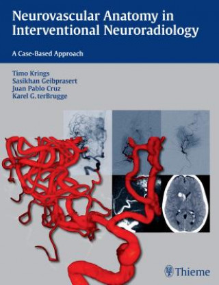 Kniha Neurovascular Anatomy in Interventional Neuroradiology Timo Krings