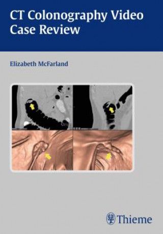 Digital Clinical Case Review of CT Colonography, CD-ROM Elizabeth McFarland