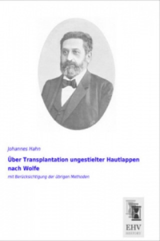 Kniha Über Transplantation ungestielter Hautlappen nach Wolfe Johannes Hahn