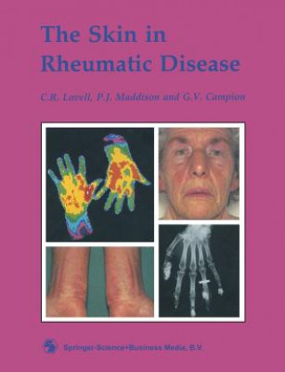 Carte Skin in Rheumatic Disease C. R. Lovell
