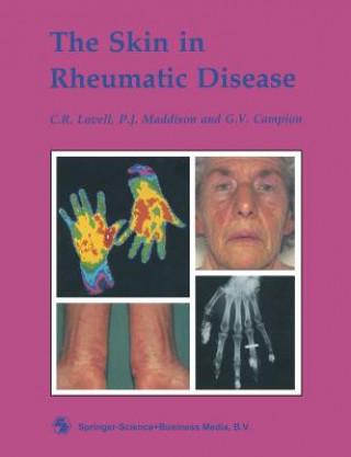 Buch Skin in Rheumatic Disease C. R. Lovell