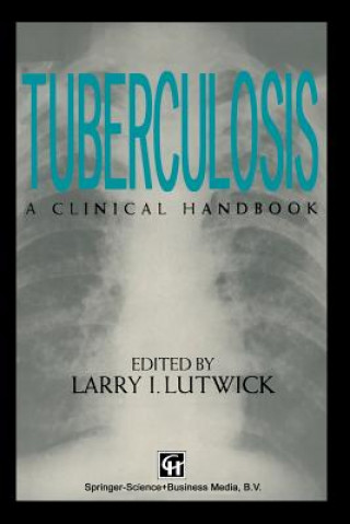 Kniha Tuberculosis Larry Lutwick