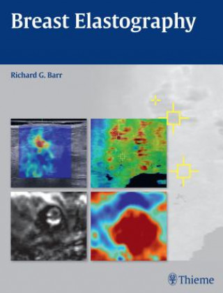 Kniha Breast Elastography Richard G. Barr