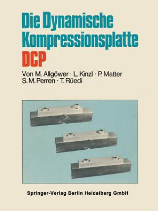 Kniha Die Dynamische Kompressionsplatte Dcp Martin Allgöwer