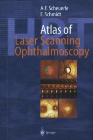 Carte Atlas of Laser Scanning Ophthalmoscopy Alexander Friedrich Scheuerle