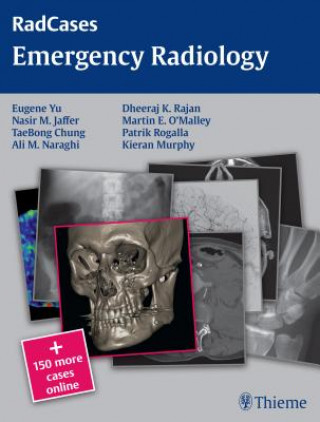 Kniha Radcases Emergency Radiology Nasir Jaffer