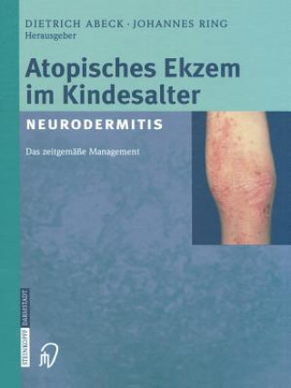 Kniha Atopisches Ekzem Im Kindesalter (Neurodermitis) D. Abeck