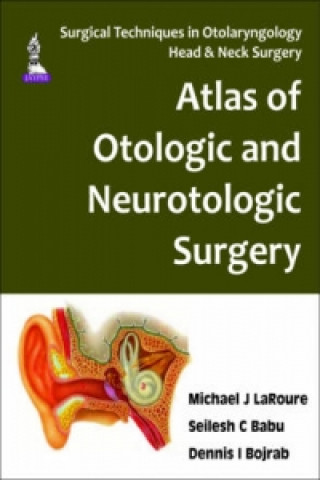 Książka Surgical Techniques in Otolaryngology - Head & Neck Surgery: Otologic and Neurotologic Surgery Michael J LaRouere