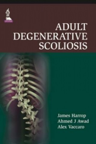 Kniha Spinal Disorders & Treatment: The NYU-HJD Comprehensive Textbook James S. Harrop