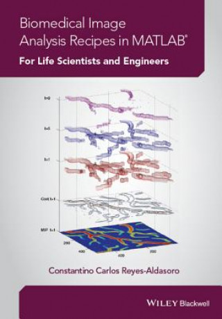 Kniha Biomedical Image Analysis Recipes in MATLAB (R) - For Life Scientists and Engineers Carlos Reyes-Aldasoro