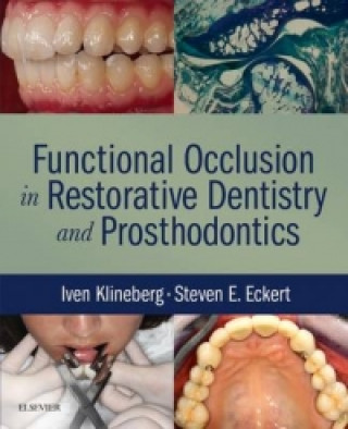 Book Functional Occlusion in Restorative Dentistry and Prosthodontics Iven Klineberg