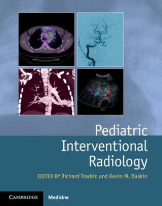 Libro Pediatric Interventional Radiology Richard Towbin