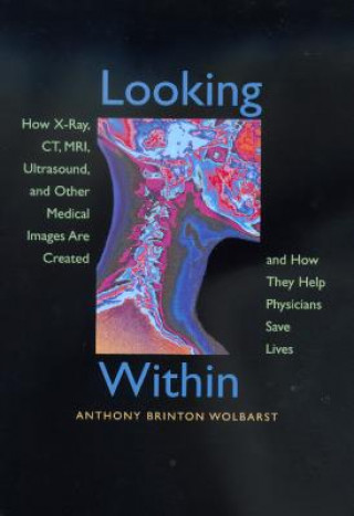 Kniha Looking Within Anthony B. Wolbarst