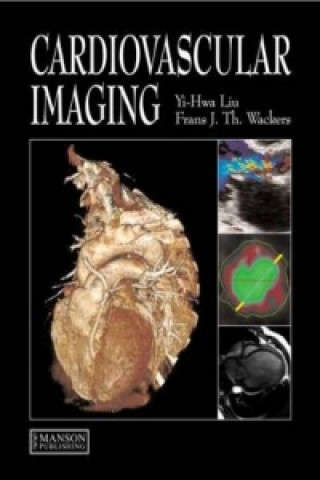 Kniha Cardiovascular Imaging Frans J. Th. Wackers